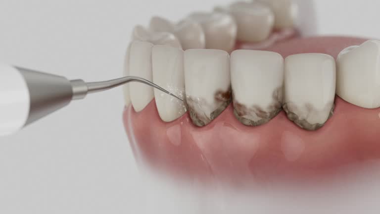 Trusted Dental Implants service in Hartshorne, OK - Dentist Open Now